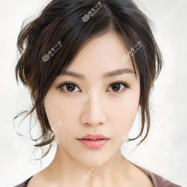 儿童正畸医生科普 儿童正畸相关治疗优缺点以及禁忌人群