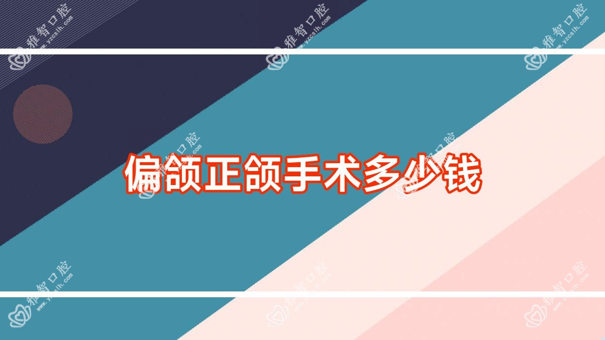 偏颌正颌手术多少钱