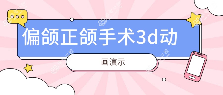 偏颌正颌手术3d动画演示