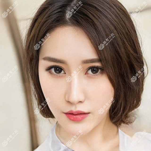 成都延期种植牙花多少钱?2869元可做,术前指南教你不被坑