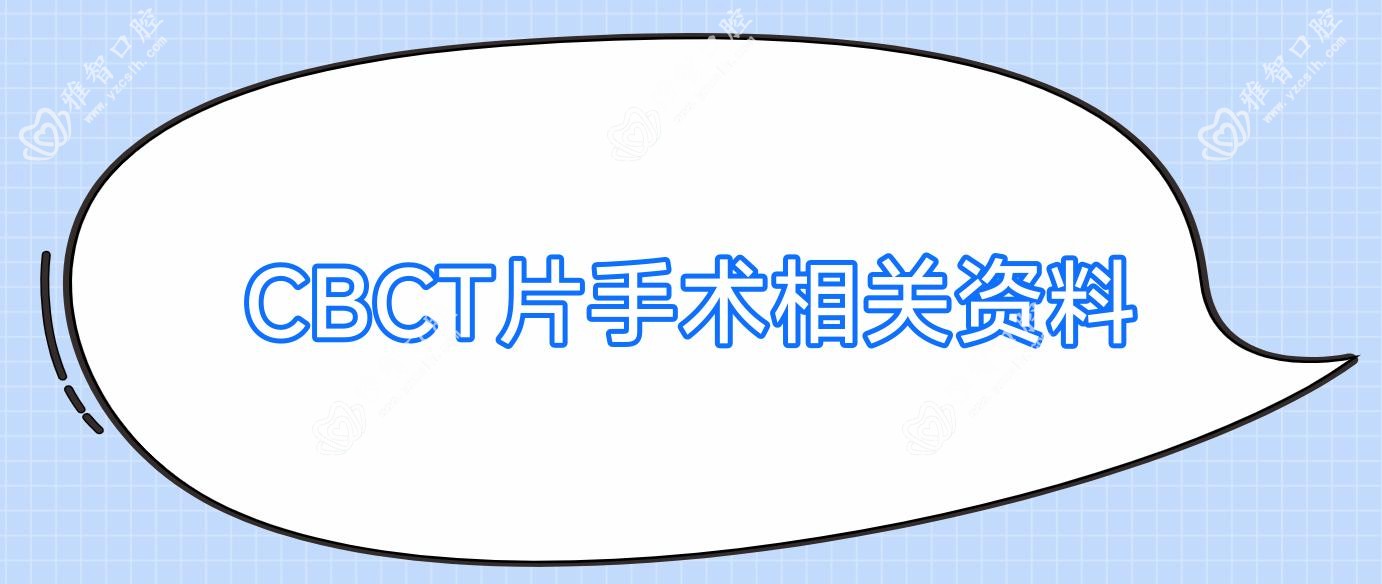 CBCT片手术相关资料