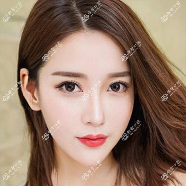 半口牙的详细资料?半口牙治疗价格贵吗?