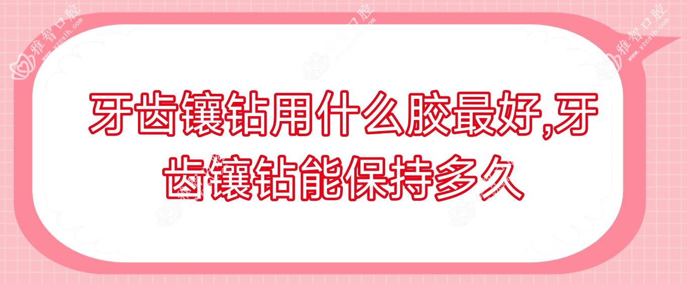 牙齿镶钻用什么胶最好,牙齿镶钻能保持多久