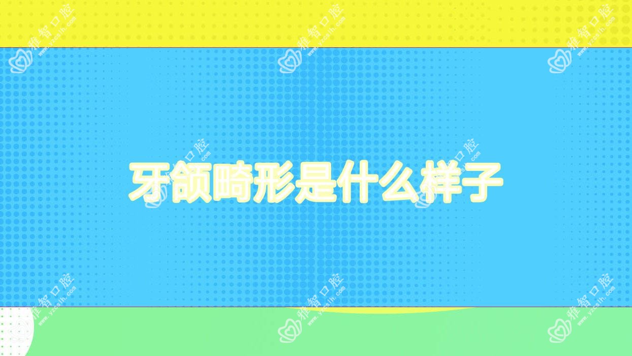 牙颌畸形是什么样子