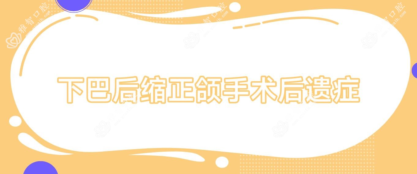 下巴后缩正颌手术后遗症