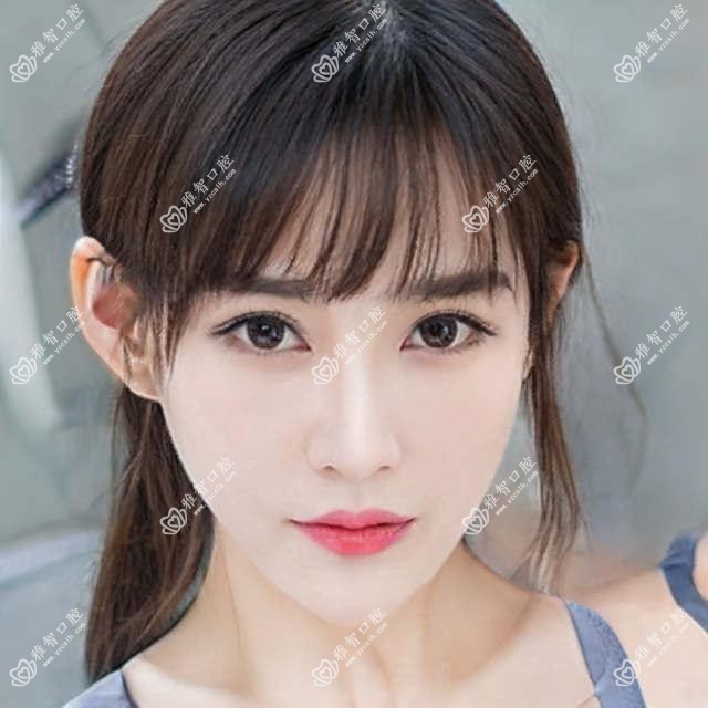 贵阳牙齿缺损修复一般多少钱?当地推荐医院介绍