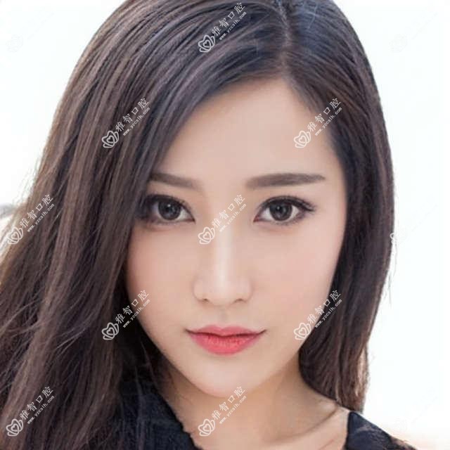 深圳自锁托槽矫正医院价目表(含深圳格伦菲尔口腔·种植正畸中心(民治水榭春天机构)/深圳中海医院口腔科•种植矫正技术中心/深圳瑞尔齿科门诊部自锁托槽矫正价格)