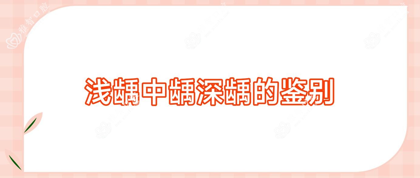 浅龋中龋深龋的鉴别