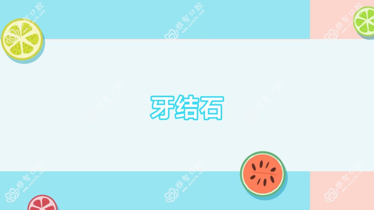 牙结石
