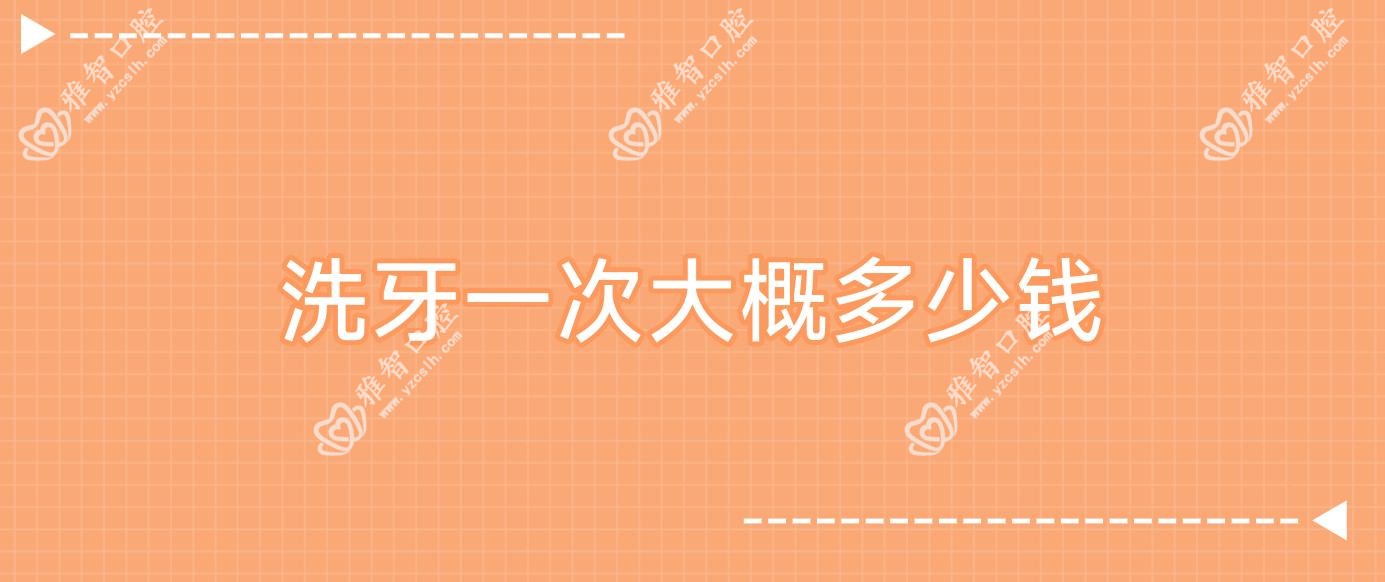 洗牙一次大概多少钱