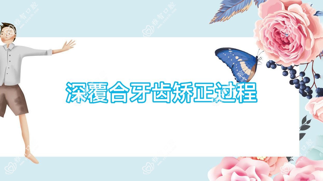 深覆合牙齿矫正过程