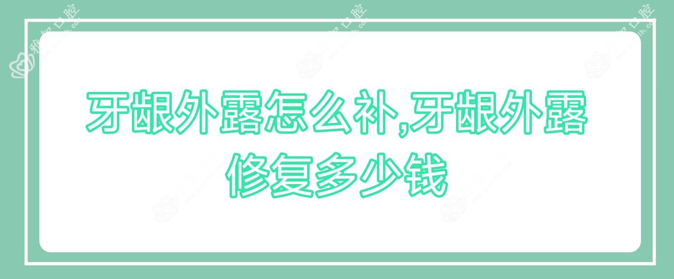 牙龈外露怎么补,牙龈外露修复多少钱
