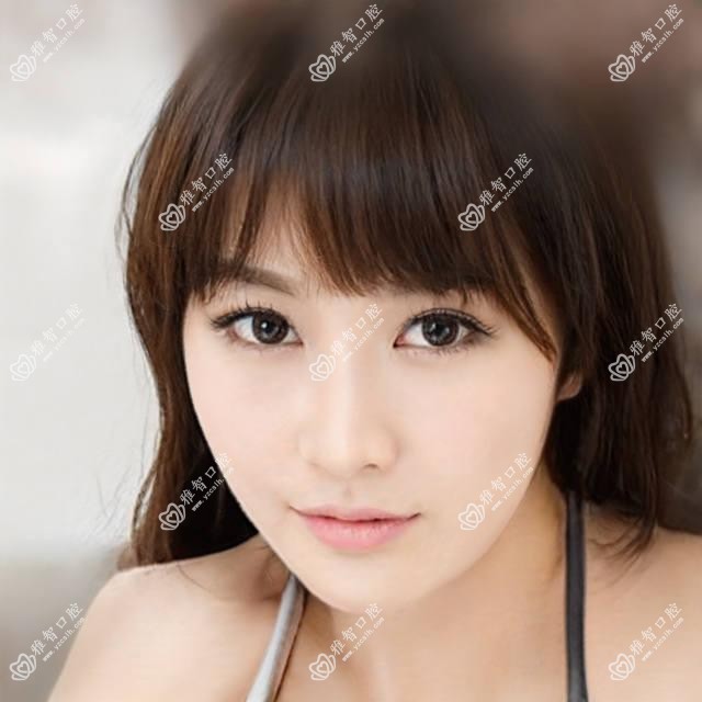 柳州美容冠价目单-柳州哪些医院美容冠成果好且收费中等