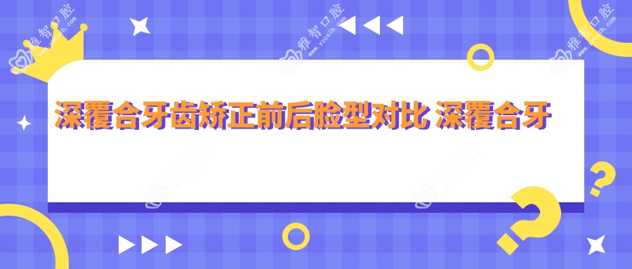 深覆合牙齿矫正前后脸型对比 深覆合牙齿矫正多少钱
