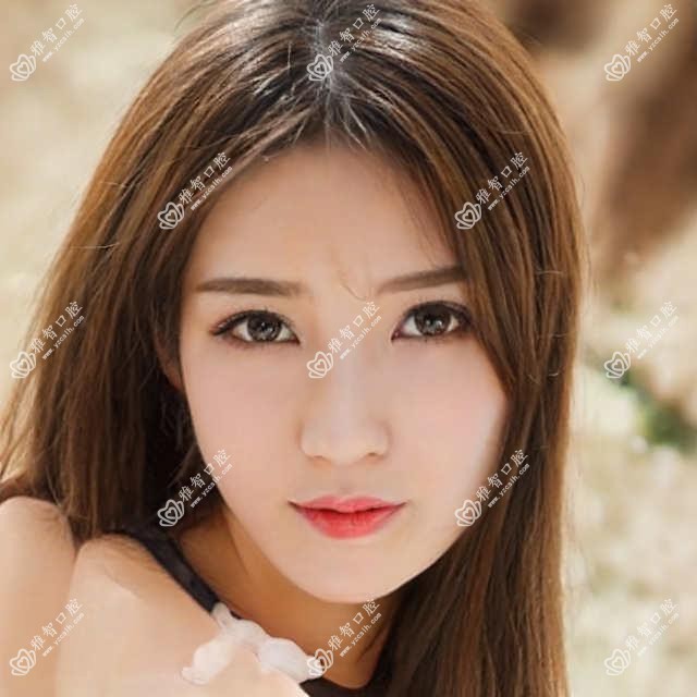 乳牙拔牙分析 乳牙拔牙相关治疗优缺点以及禁忌人群