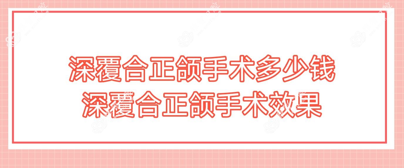 深覆合正颌手术多少钱 深覆合正颌手术疗效