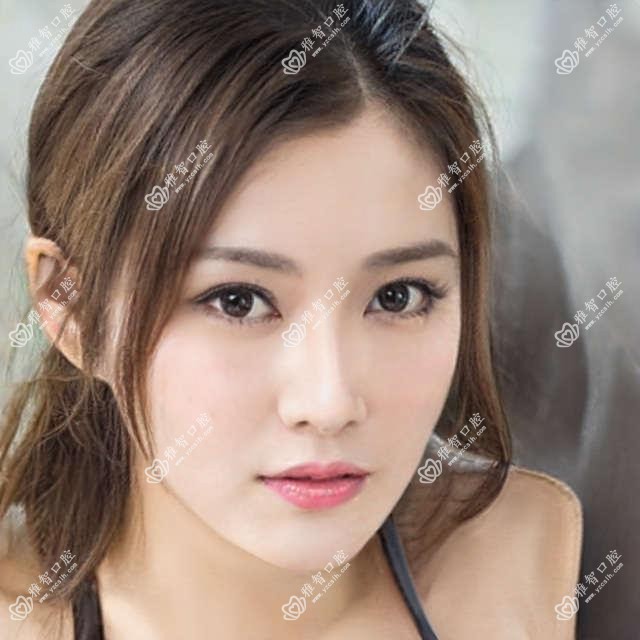 2025年太原隐形矫正器价目单:隐形矫正器12068+隐适美隐形矫正器2.5万+正雅隐形矫正器1.2万+时代天使隐形矫正器2.8万+