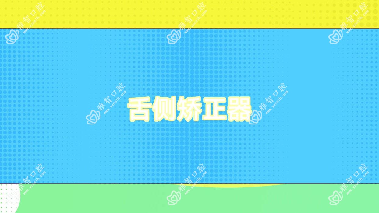 舌侧矫正器
