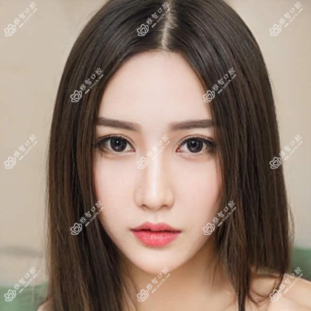 固定义齿是什么?固定义齿治疗方案推荐?