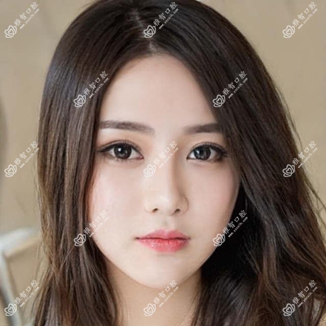 2025厦门医院百齿泰种植牙收费价格单:泰安康盛种植体6k+|创英种植体4.3k+|百齿泰种植牙4.5k+