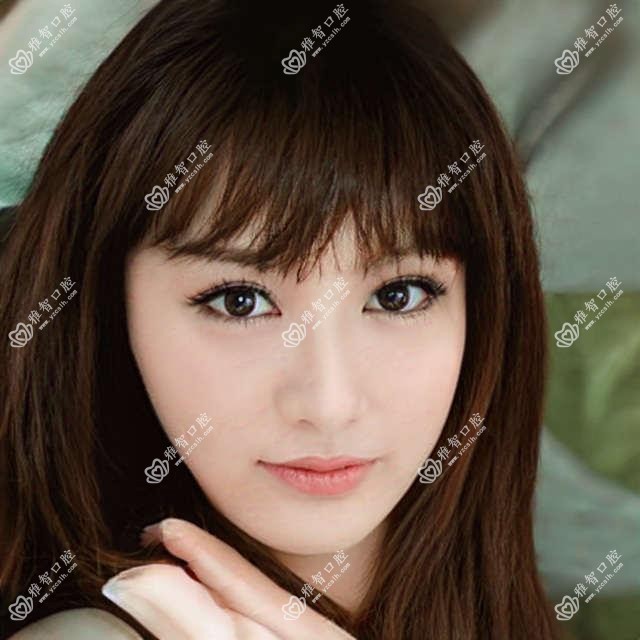 镶牙考虑因素有哪些?镶牙治疗方案推荐?