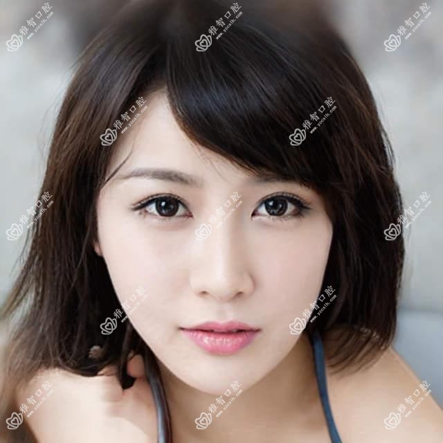 中山透明隐形矫正多少钱?2025收费表揭秘了~中山透明隐形矫正费用标准赶快看!