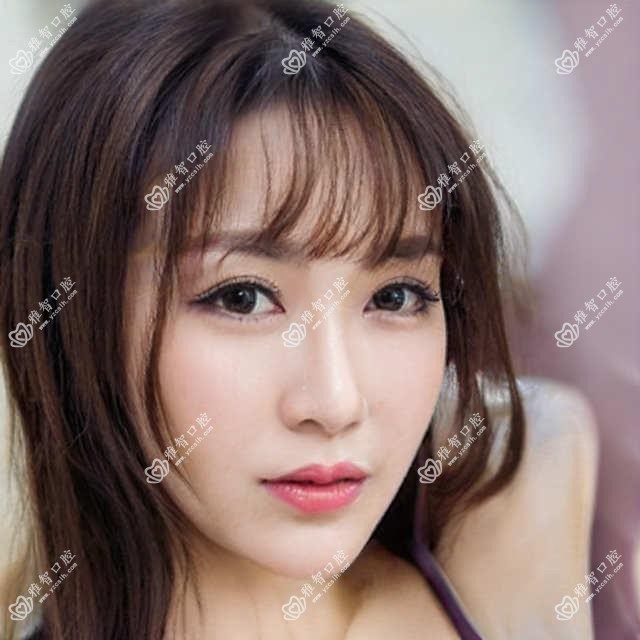 Zimmer的详细资料?Zimmer相关操作详细介绍?