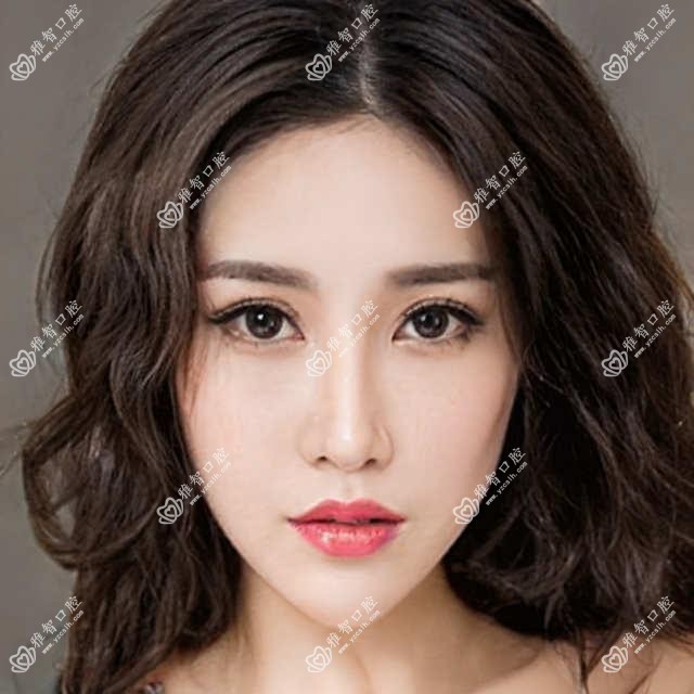 宁波深覆合正颌手术价格表，地址在宁波北仑区/镇海区/奉化区深覆合正颌手术价格在9099-21358元