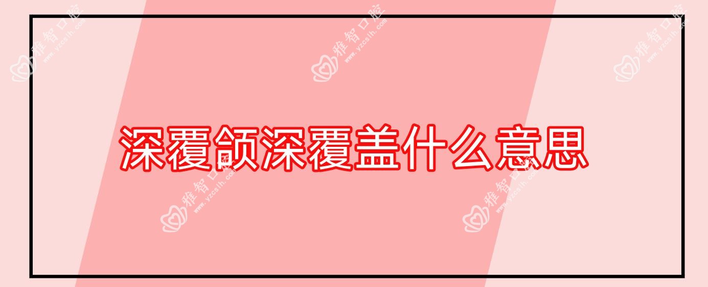深覆颌深覆盖什么意思