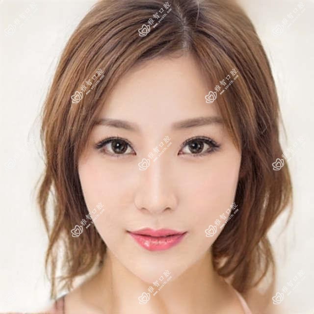 隐适美怎么治疗(隐适美治疗价格贵吗)