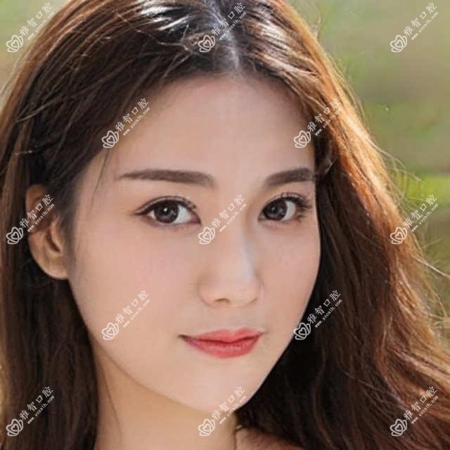 松动牙是什么?松动牙相关治疗优缺点以及禁忌人群?