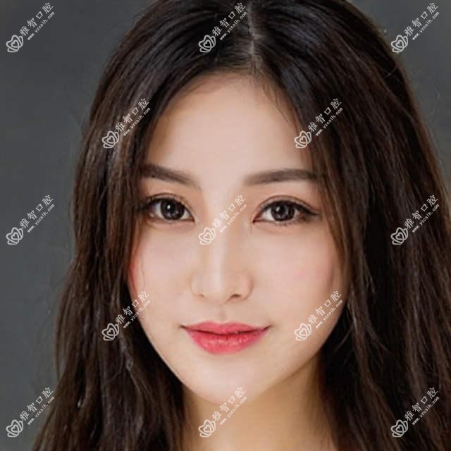 根管治疗考虑因素有哪些?根管治疗手术注意事项?