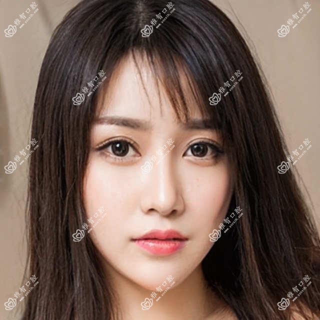 金华半口牙种植花多少钱?前牙种植1w元左右