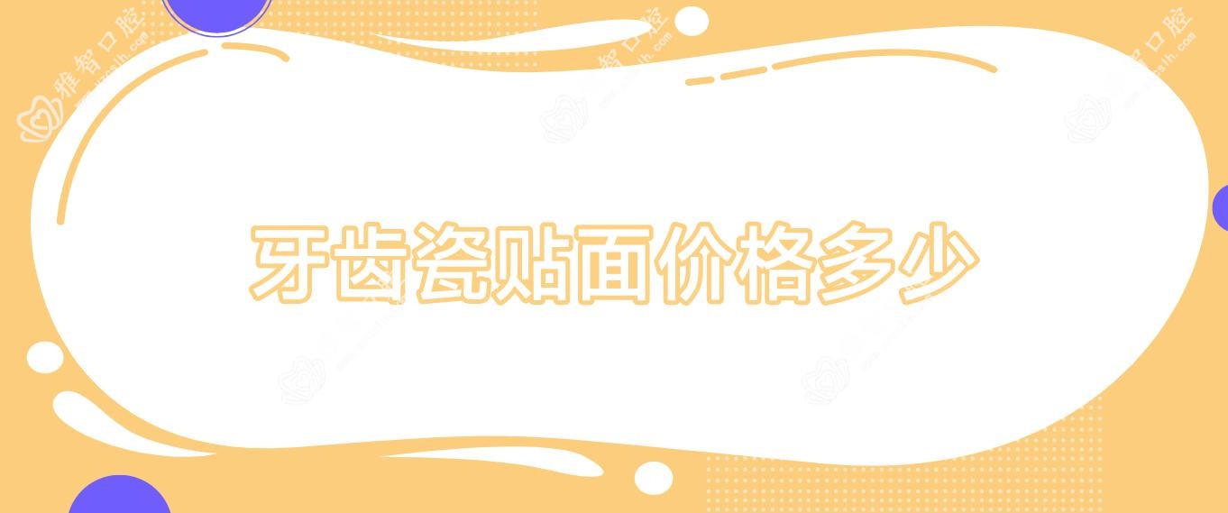 牙齿瓷贴面价格多少