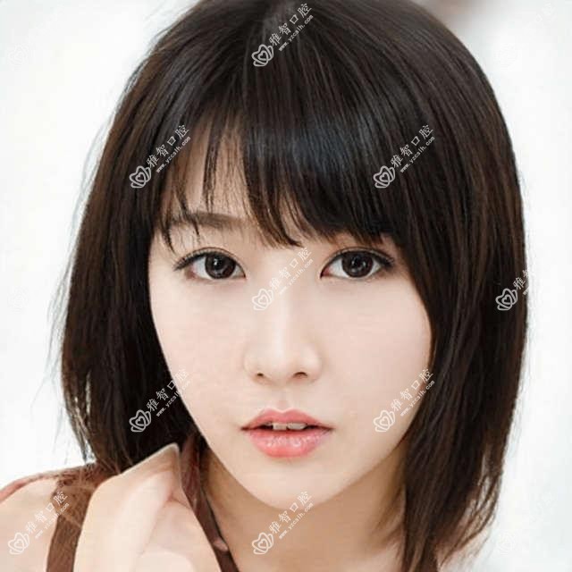 活动义齿的项目百科,活动义齿相关治疗优缺点以及禁忌人群