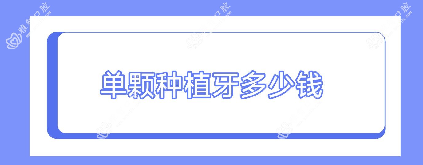 单颗种植牙多少钱