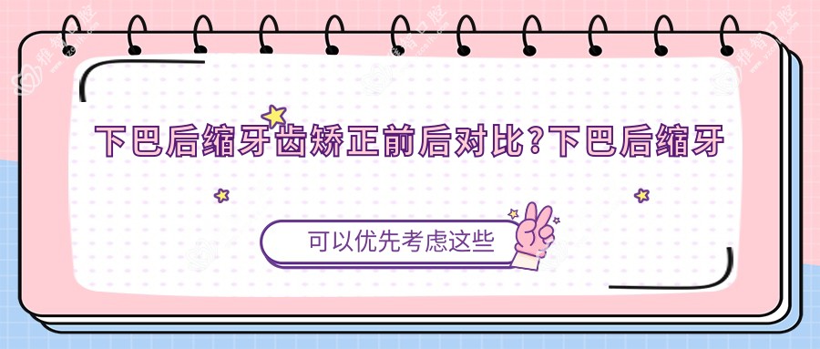 下巴后缩牙齿矫正前后对比?下巴后缩牙齿矫正能改善吗?