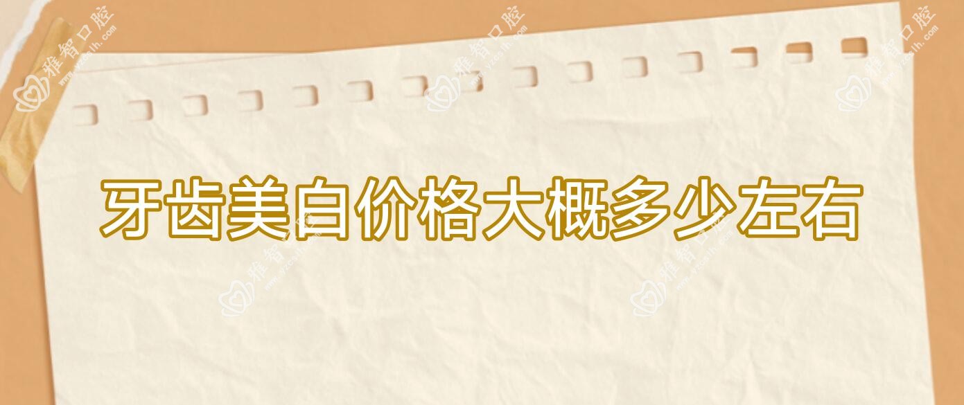 牙齿美白价格大概多少左右