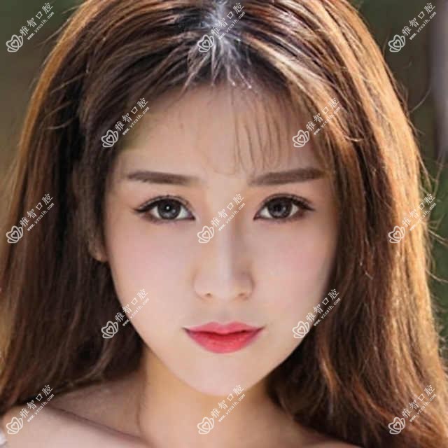 Zimmer考虑因素有哪些?Zimmer治疗价格贵吗?
