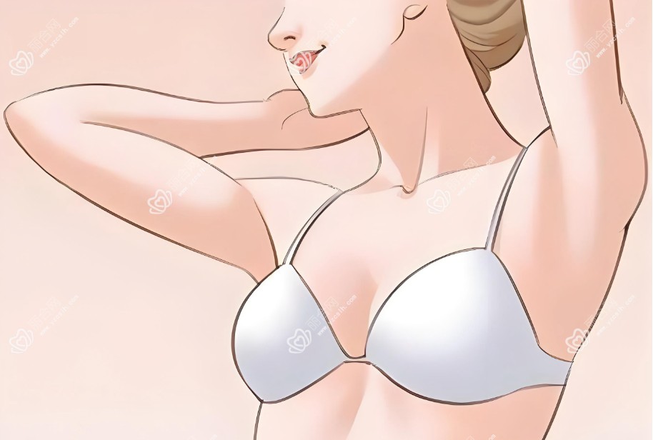 隆胸后母乳喂养的注意事项