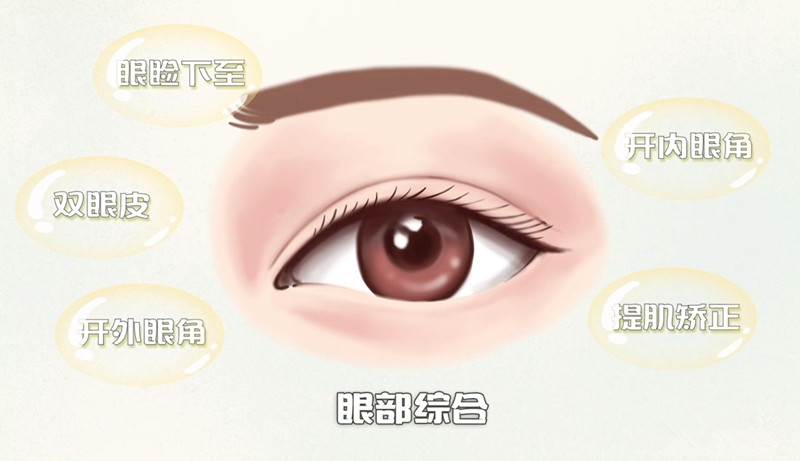 赵丽双眼皮修复术后护理