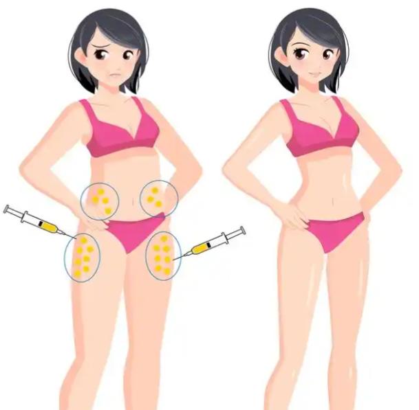 五、南宁抽脂手术大概要多少钱，如何选择高性价比方案