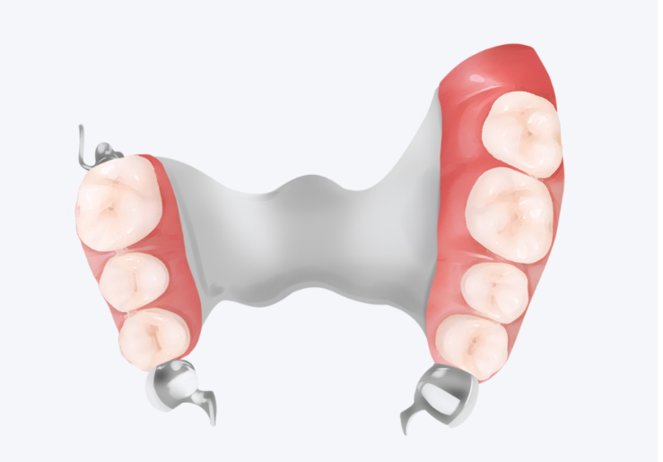 包头市东河区贾氏牙科镶牙技术怎么样？3000元起性价比高，牙冠修复自然美观！