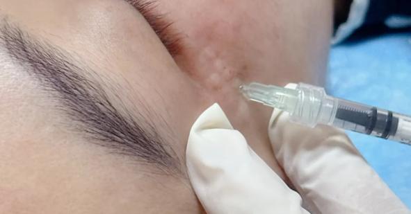 松江欧莱美打水光针怎么样？不割韭菜的良心推荐，效果和价格都合理