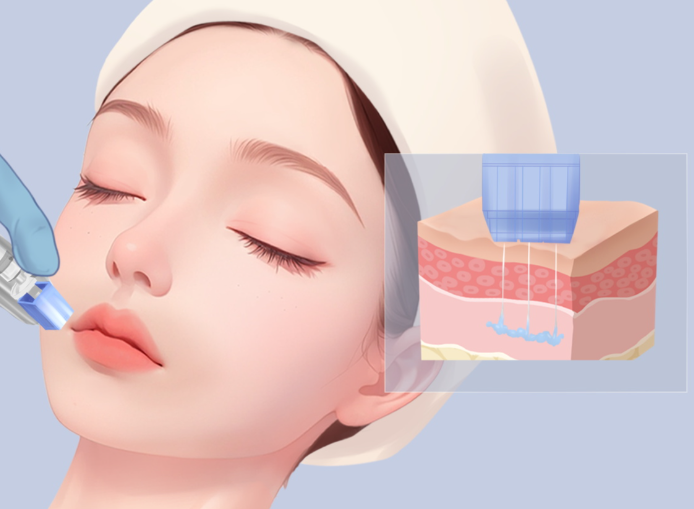 五、如何选择适合自己的项目？