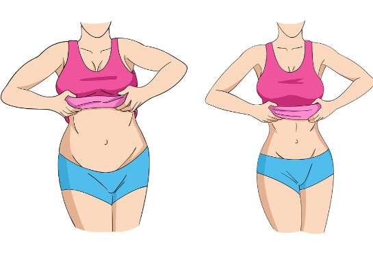 三、成都腹壁整形手术的价格参考与选择建议