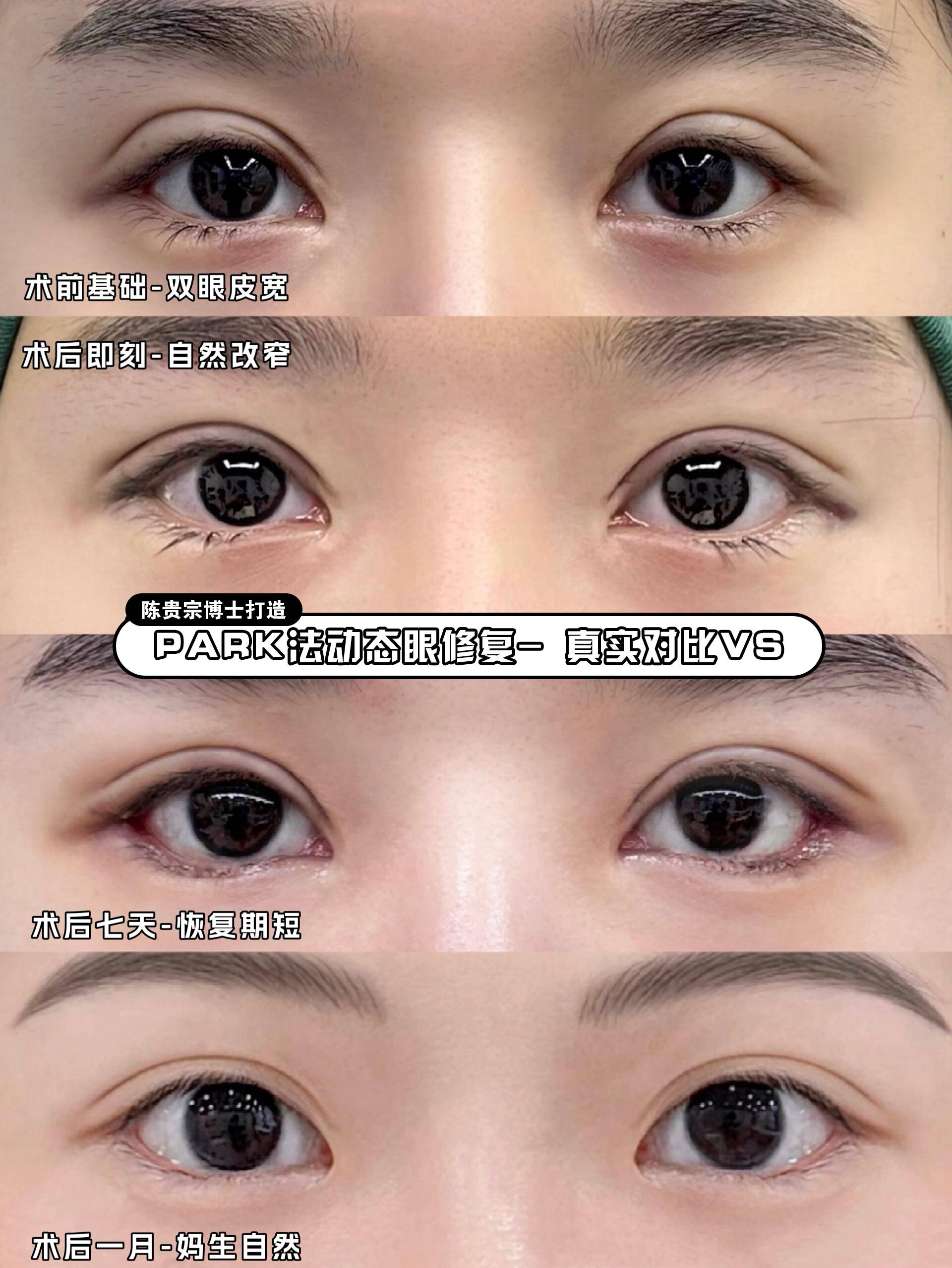 三、广州美莱口腔