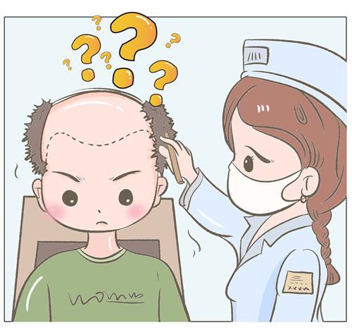 五、合肥大麦微针植发术后护理：贴心服务，确保疗效