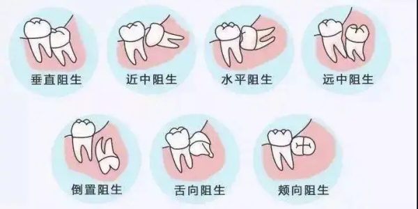 40岁还有必要拔智齿吗？价格差异高达4500元至8000元，哪种方案更划算？