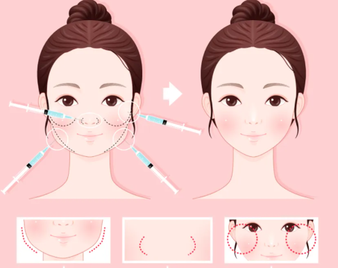 二、婕尔和伊婉V哪个适合打苹果肌？适用人群与场景分析